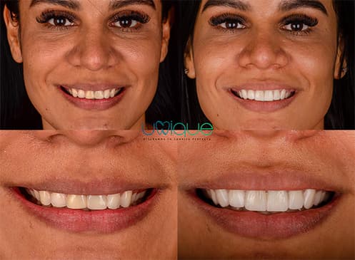 Slider image (3) Unique Dental Clinic